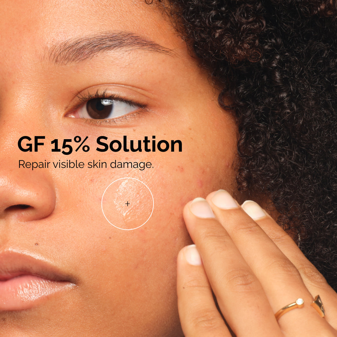 Solution GF 15 % – The Ordinary | 30 ml
