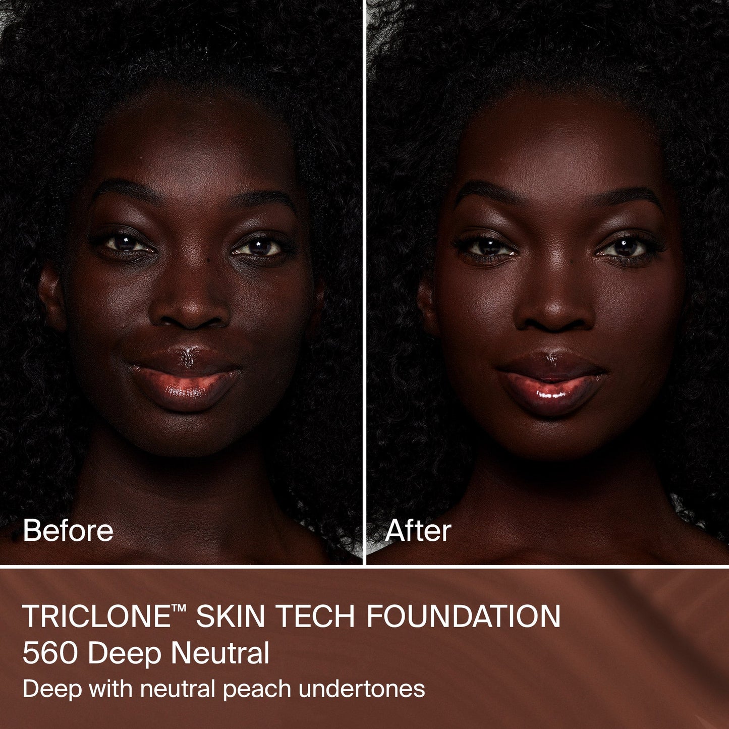 TRICLONE™ SKIN TECH MEDIUM COVERAGE FOUNDATION