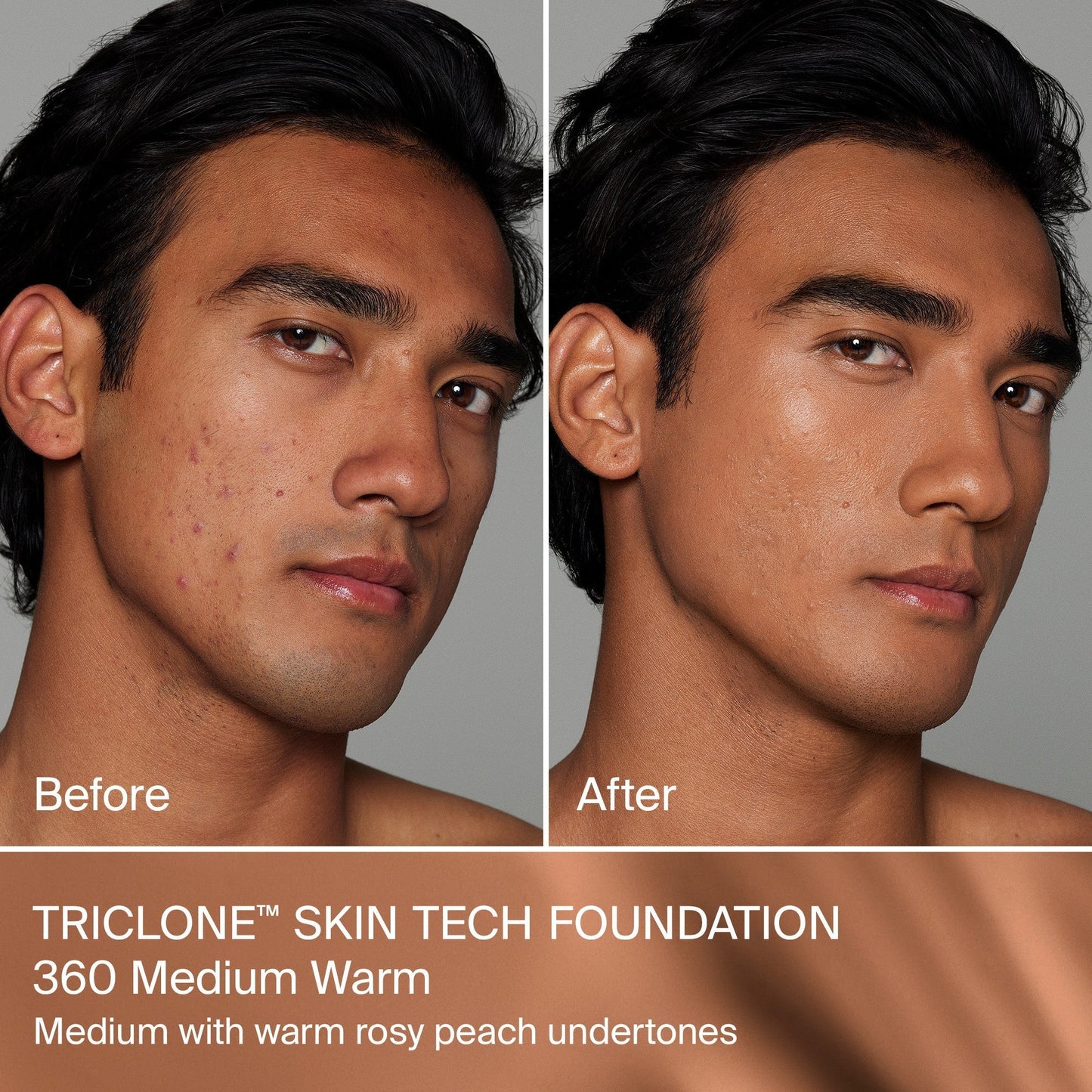 TRICLONE™ SKIN TECH MEDIUM COVERAGE FOUNDATION