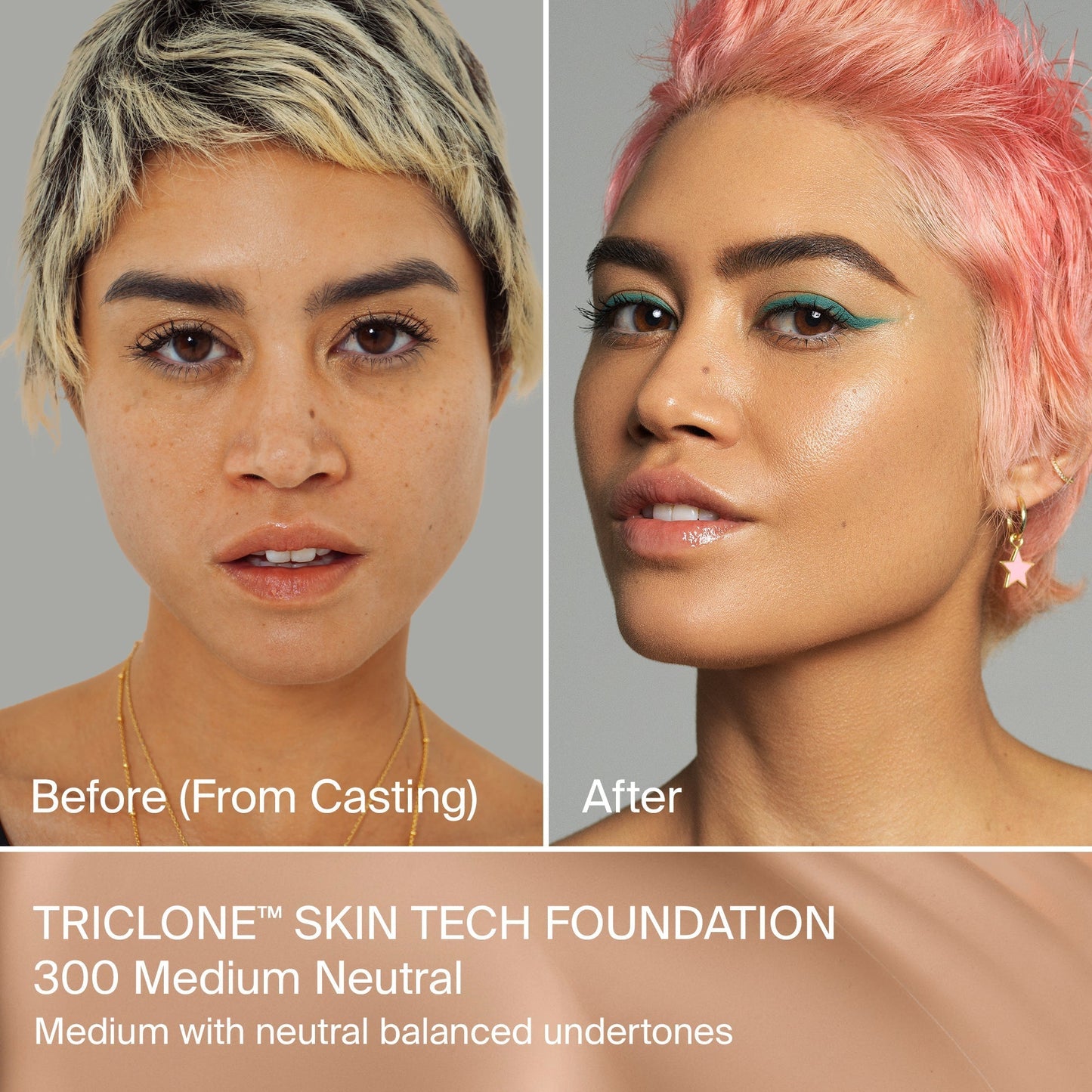 TRICLONE™ SKIN TECH MEDIUM COVERAGE FOUNDATION