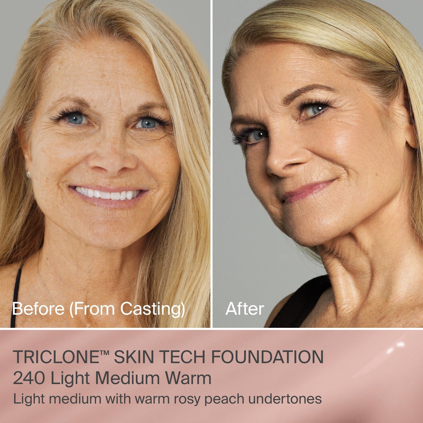 TRICLONE™ SKIN TECH MEDIUM COVERAGE FOUNDATION