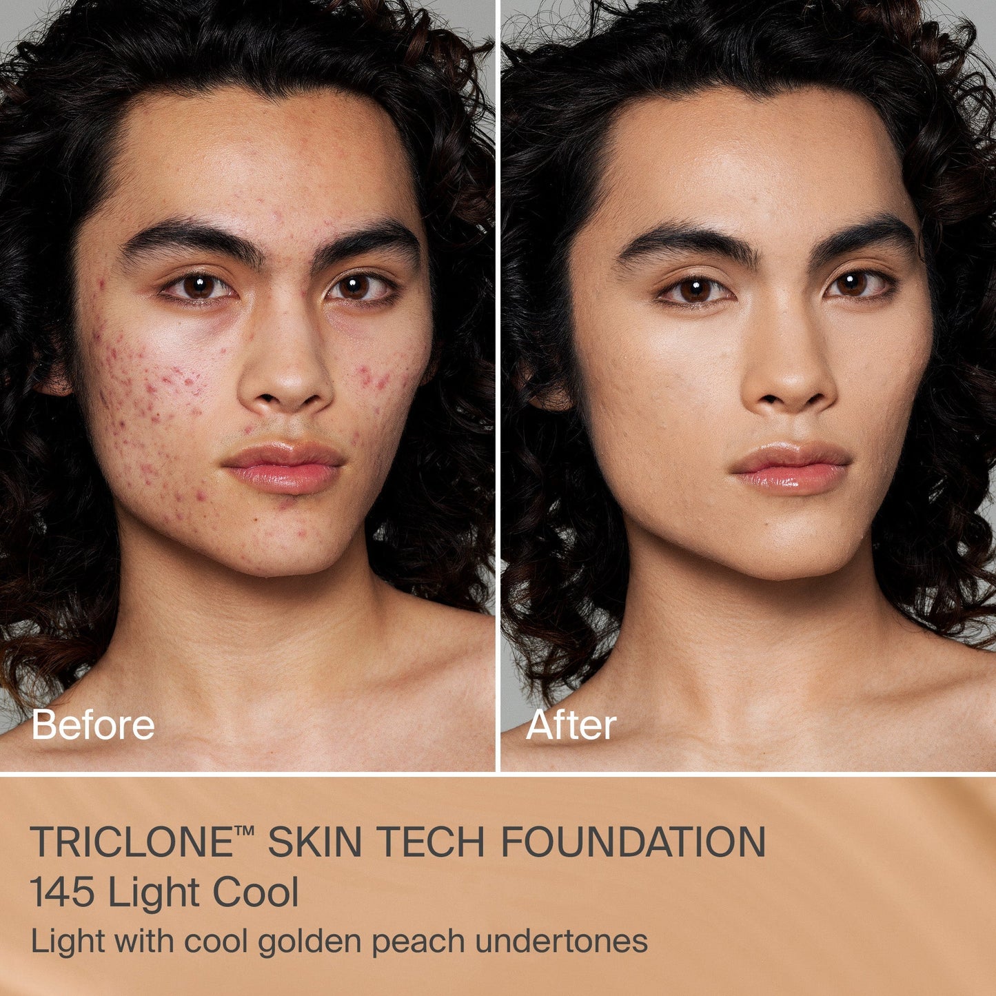 TRICLONE™ SKIN TECH MEDIUM COVERAGE FOUNDATION