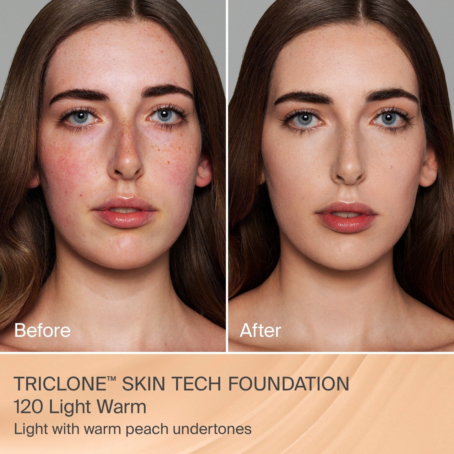 TRICLONE™ SKIN TECH MEDIUM COVERAGE FOUNDATION