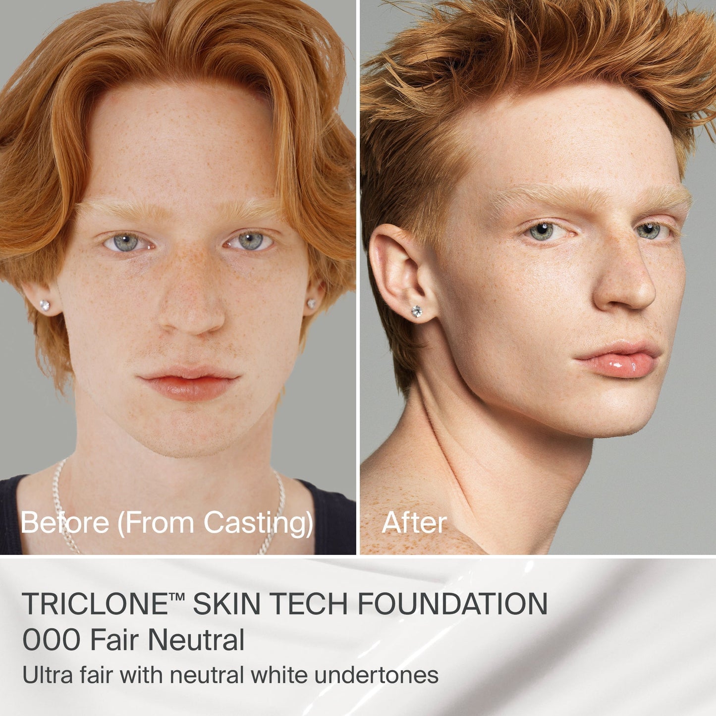 TRICLONE™ SKIN TECH MEDIUM COVERAGE FOUNDATION