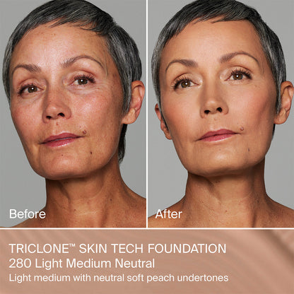 TRICLONE™ SKIN TECH MEDIUM COVERAGE FOUNDATION