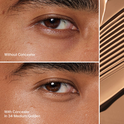 TRICLONE™ SKIN TECH CONCEALER