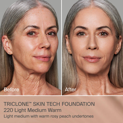 TRICLONE™ SKIN TECH MEDIUM COVERAGE FOUNDATION