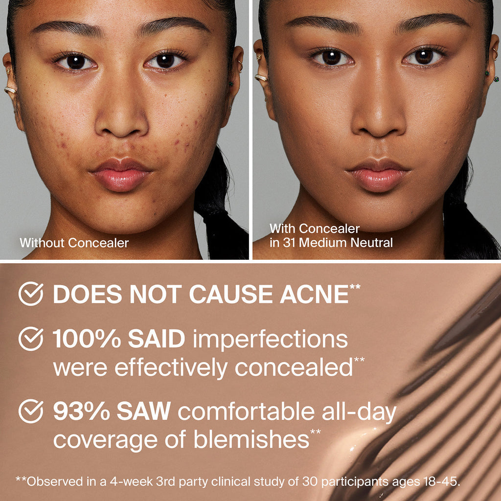 TRICLONE™ SKIN TECH CONCEALER