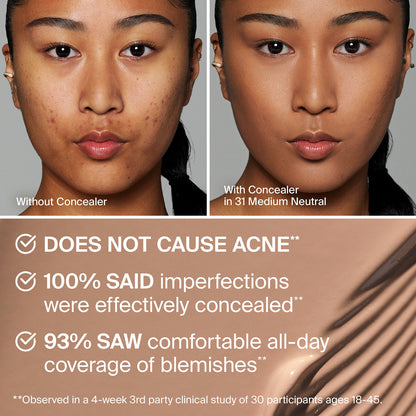 TRICLONE™ SKIN TECH CONCEALER