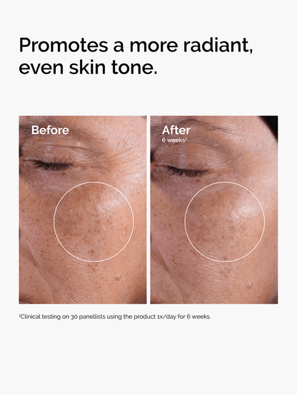 Lotion Tonique Exfoliante à l’Acide Glycolique 7 % – The Ordinary | 240 ml