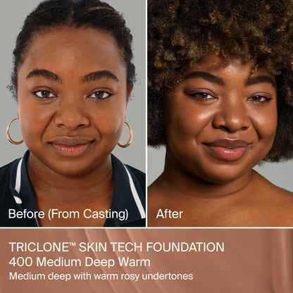 TRICLONE™ SKIN TECH MEDIUM COVERAGE FOUNDATION