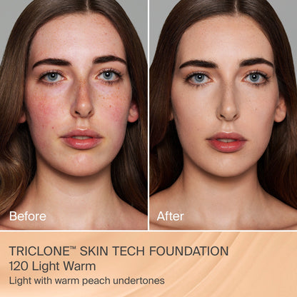 TRICLONE™ SKIN TECH MEDIUM COVERAGE FOUNDATION
