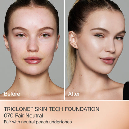 TRICLONE™ SKIN TECH MEDIUM COVERAGE FOUNDATION